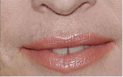 Fa cunostinta cu cele mai infioratoare defecte ale celebritatilor!