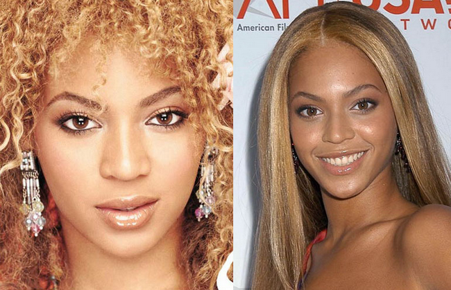 Secretul perfectiunii: operatiile estetice la nas!