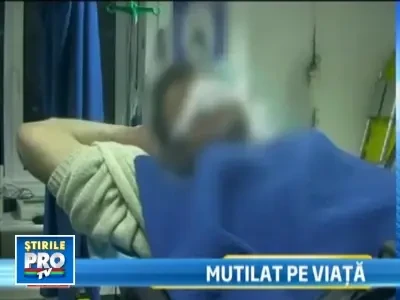 A ajuns la spital fara varful nasului! L-a muscat un prieten