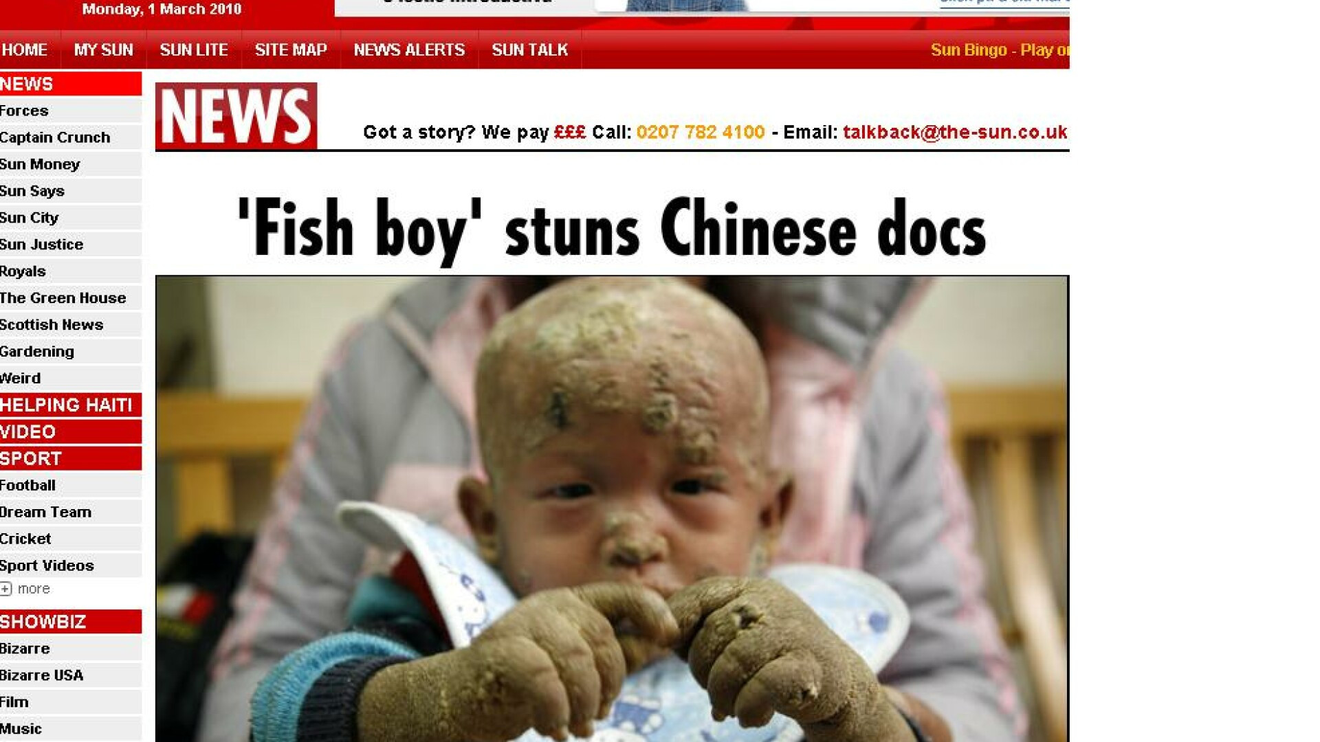 INCREDIBIL! “Baiatul peste” traieste in China