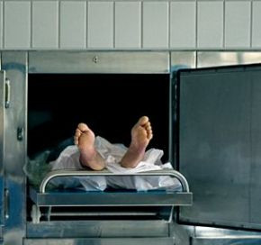 I-au expus creierul intr-un borcan fara a cere permisiunea parintilor