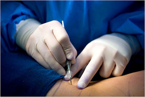 Daniela Gyorfi si "Blonda lui Iri", abonate la bisturiu! VIDEO!