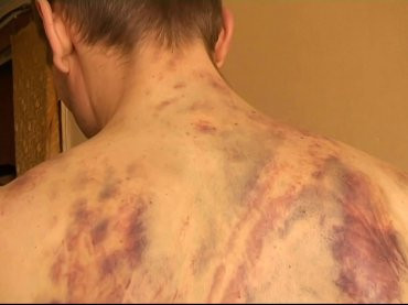 Fost condamnat, lasat aproape fara suflare la poarta spitalului