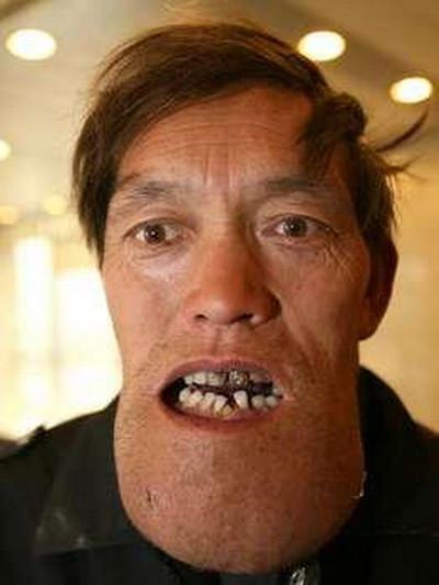 Ii "explodeaza" barbia! IMAGINI SOCANTE!