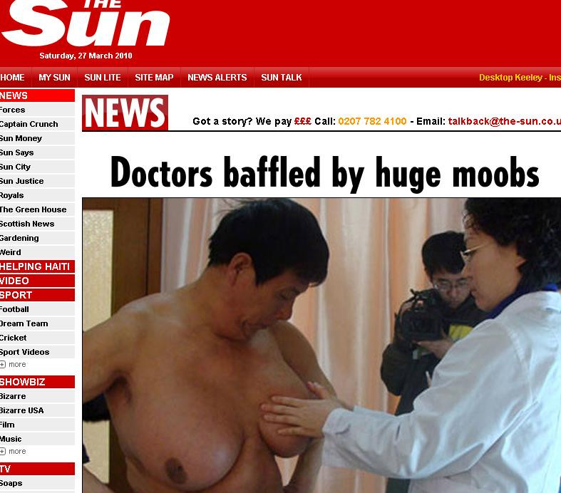 IMPRESIONANT! Uite-l pe barbatul cu cei mai mari sani din lume!