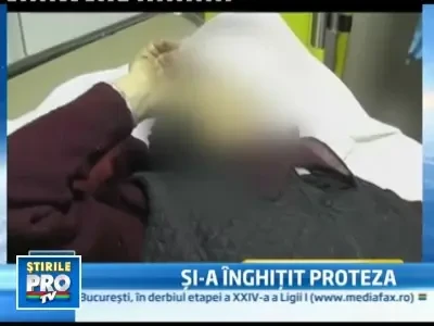 La un pas de moarte dupa ce si-a inghitit in somn proteza dentara!