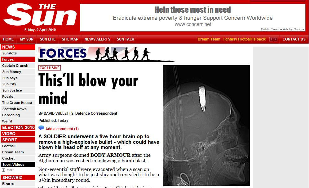 Atentie, pericol de explozie! A ajuns la spital cu un glont in cap