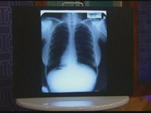 Ai cumpara radiografii cu pieptul si bazinul actritei Marilyn Monroe?!