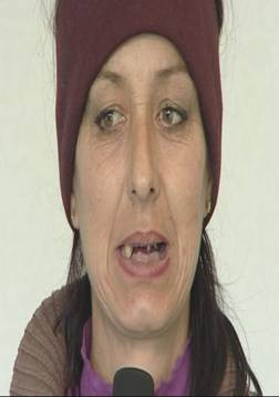 Doua mame primesc o noua sansa la ”Frumusete pe muchie de cutit”