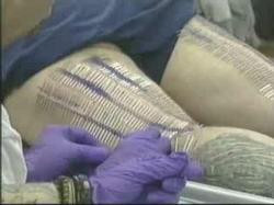 Perna de ACE umana! Si-a facut 2.100 de piercinguri intr-o singura zi!