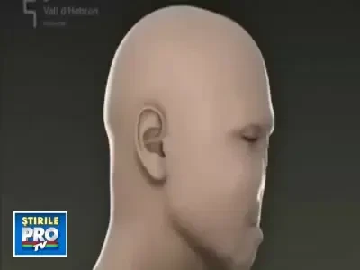 FACE OFF: S-a realizat primul transplant facial TOTAL!