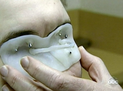 Fata cu jumatate de faţă! Afla-i povestea incredibila! VIDEO