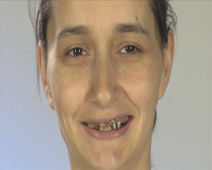 "Ma simt un monstru!"O noua sansa la "Frumusete pe muchie de cutit"