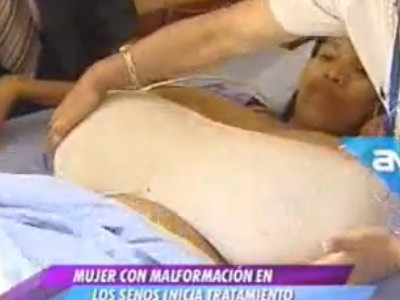 SOCANT! Femeia cu cei mai mari sani! Ii ajungeau pana la PICIOARE! Video