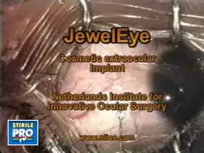 Ce-ai zice de un piercing in ochi? Uite cum se face!