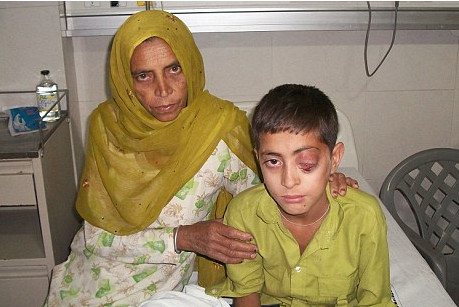 MIRACOL! A trait cu un bat infipt in CREIER timp de 2 ani!