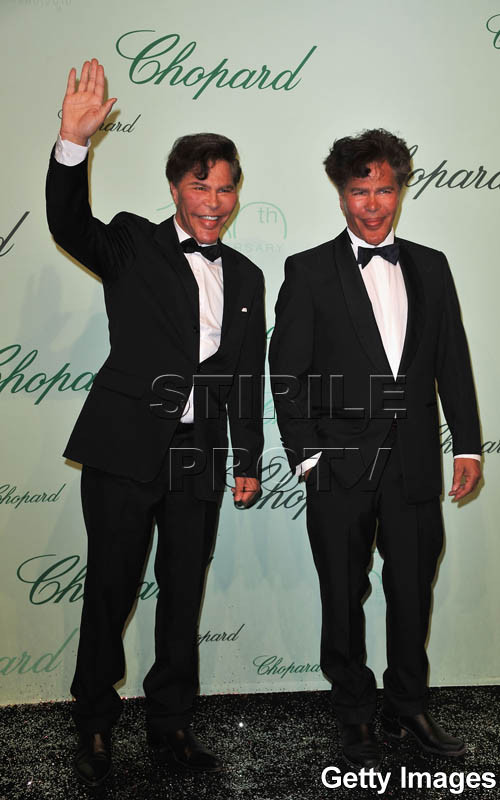 Pe vremuri barbati ravniti, acum mutilati de operatiile estetice! FOTO