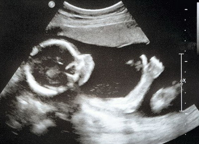 Ecografie INCREDIBILA! "Mami, nu-ti face griji... sunt OK!"