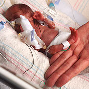 Bebelus cat un creion. Nascut prematur, un baietel a uimit lumea medicala