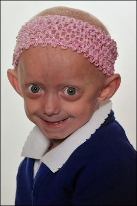 Fetita de 7 ani, in corp de bunica! Imbatraneste de 8 ori mai repede