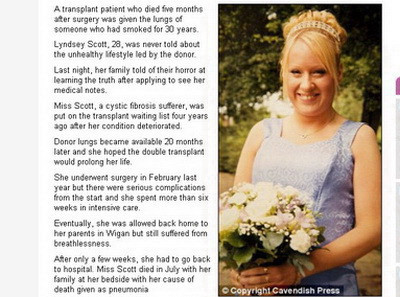 Incredibil! A murit dupa ce i s-au transplantat plamanii unui fumator