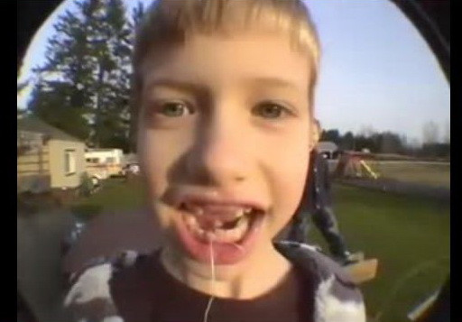 Cum "extragem" un dinte fara ajutorul dentistului? Cu racheta!