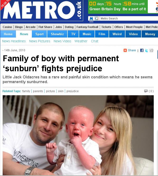 Chinuit de o boala necrutatoare! Are pielea plina de eczeme si basici