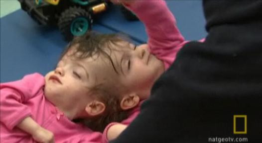 Caz unic in lume! Siamezele care isi pot citi gandurile