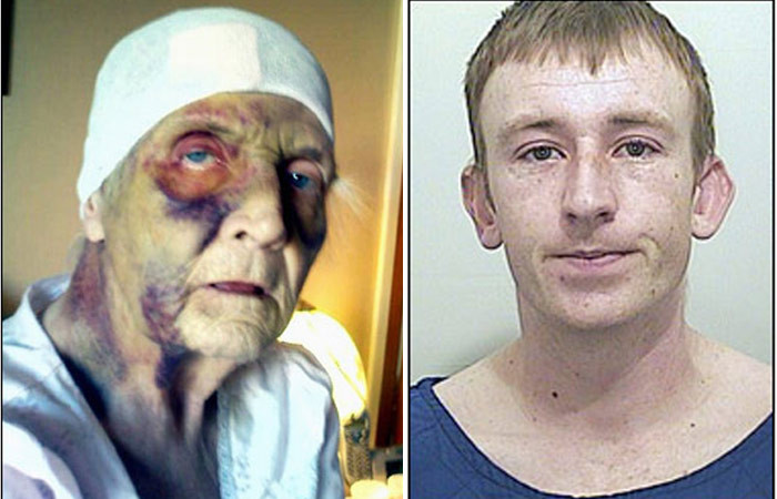 A refuzat sa moara, pana nu si-a vazut agresorul pedepsit!