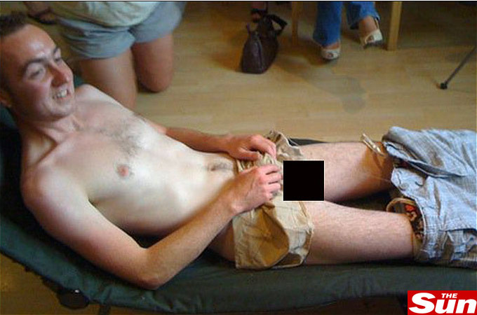 Epilatul inghinal era sa-l lase fara un testicul