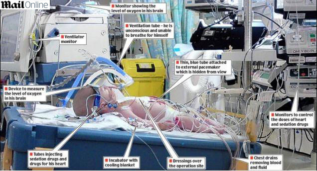 Incredibil! Bebelus inghetat de medici 4 zile, ca sa ii salveze viata