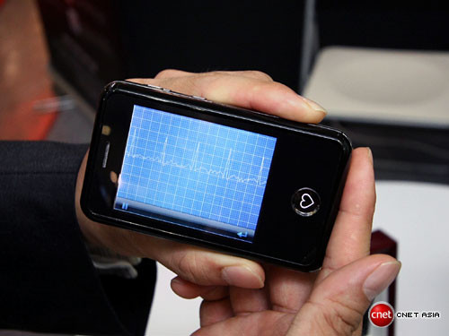 Telefonul cardiolog! Vezi ce "investigatii" poate face