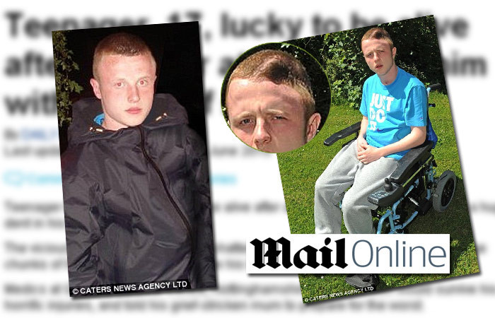 Traieste fara o bucata din CRANIU, dupa ce a fost lovit cu un CIOCAN!