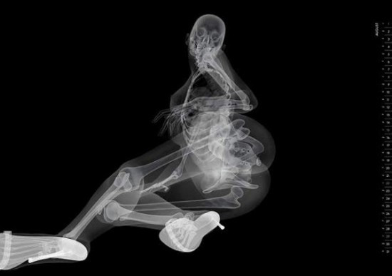 Isi promoveaza spitalul cu radiografii sexy! Galerie foto