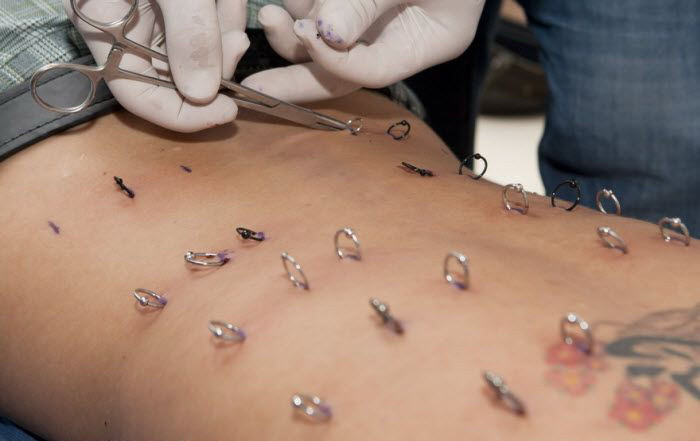 IMAGINI SOCANTE! Se mutileaza pentru a fi "cool"