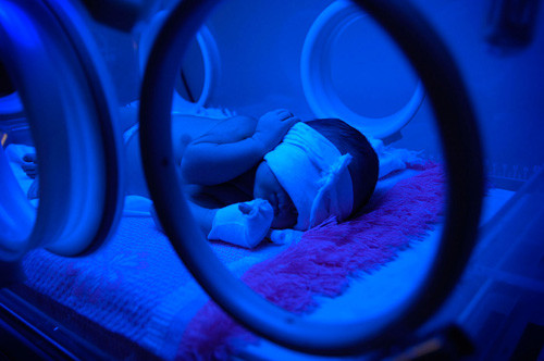 O fetita de numai o zi, arsa cu apa clocotita de o asistenta neglijenta!