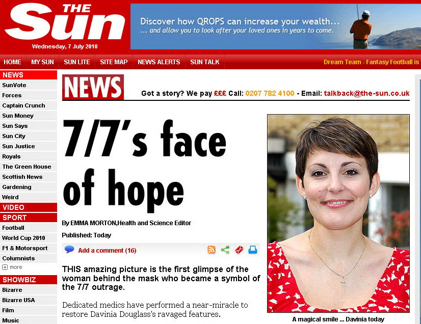 Desfigurata complet in atentatul din 2005 din Londra, si-a revenit uimitor!