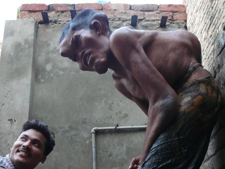 Omul cu chip de monstru! Doctorii: Este unic in lume