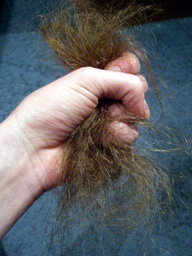 Boala periculoasa! Isi smulge parul din cap: era sa ramana cheala!