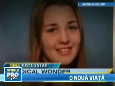 Fata cu jumatate de fata a primit un nou chip