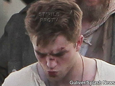 Robert Pattinson, batut si insangerat! Si-a luat-o!