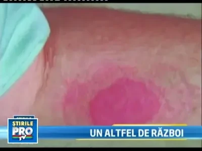 Invazie de plosnite in SUA! Oamenii sunt terorizati