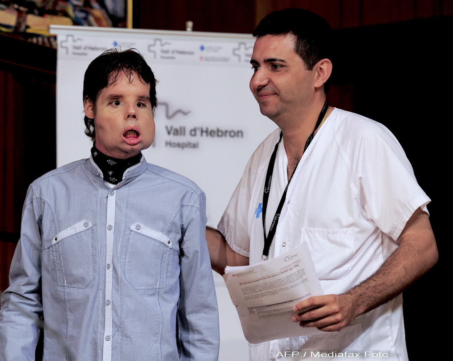 Uite cum arata barbatul care a suferit primul transplant total de fata