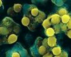 Situatie alarmanta in SUA. Autoritatile au descoperit ca o bacterie letala a "scapat" dintr-un laborator