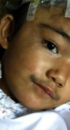 Fetita-maimuta! A fost parasita de parinti pentru ca este acoperita de par!