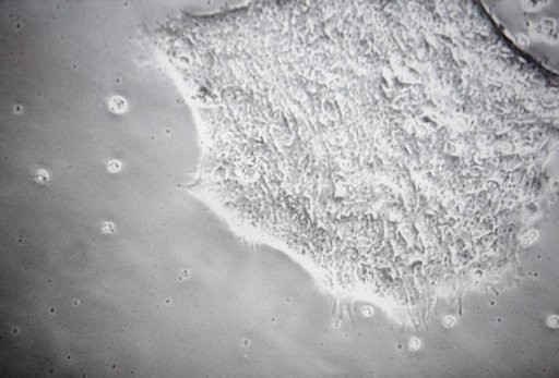 Premiera. Celule hepatice obtinute... din piele!