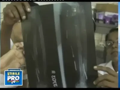 Chinuita ca Isus pe cruce!O menajera, strapunsa cu 24 de cuie in tot corpul