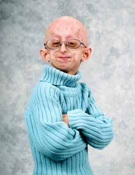 progeria
