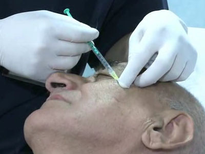 VIDEO SOC: Viorel Lis si-a injectat Botox!