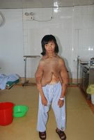 Socant! Femeia al carei corp pare ca se topeste!